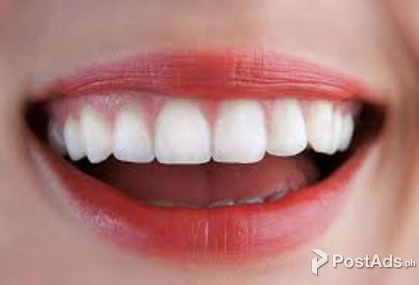 SnoWhite Teeth Whitening:-Its 3D cleansing brush remove bacteria from 