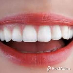 SnoWhite Teeth Whitening:-Its 3D cleansing brush remove bacteria from | PostAds PH