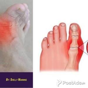 Nail Fungus Causes and Treatments | PostAds PH