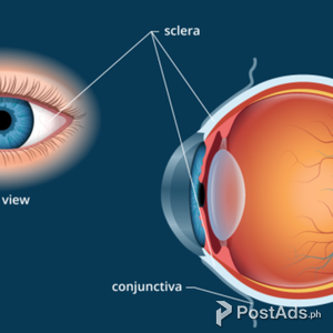 Sniper Vision System | PostAds PH