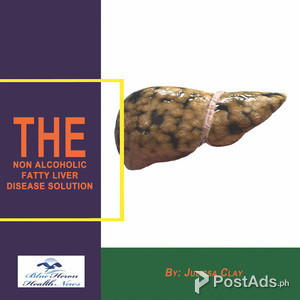Non Alcoholic Fatty Liver Strategy | PostAds PH