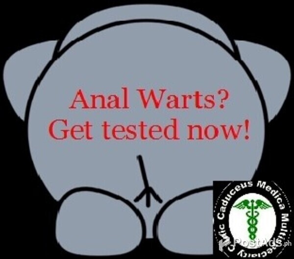 STD Warts Removal Clinic