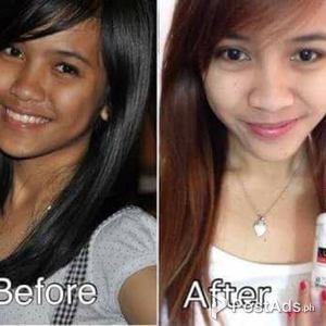 WORLDS MOST EFFECTIVE SKIN WHITENNING | PostAds PH